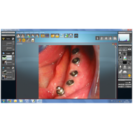 EKLER Dental Imaging System