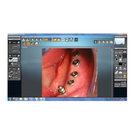 EKLER Imaging Dental System